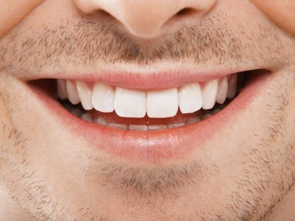 affordable dental crowns and bridges near me