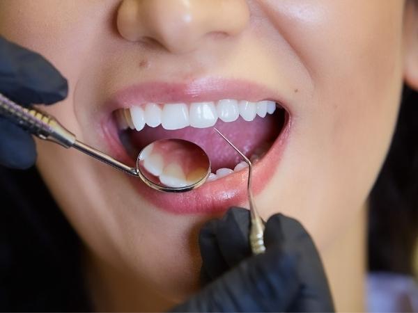 Dental hygienist Cheshire